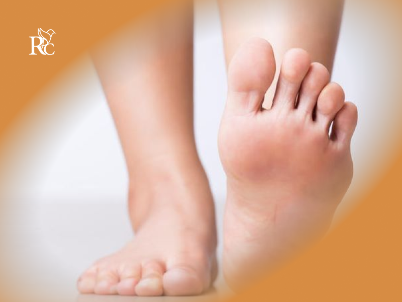 داغ شدن کف پاها